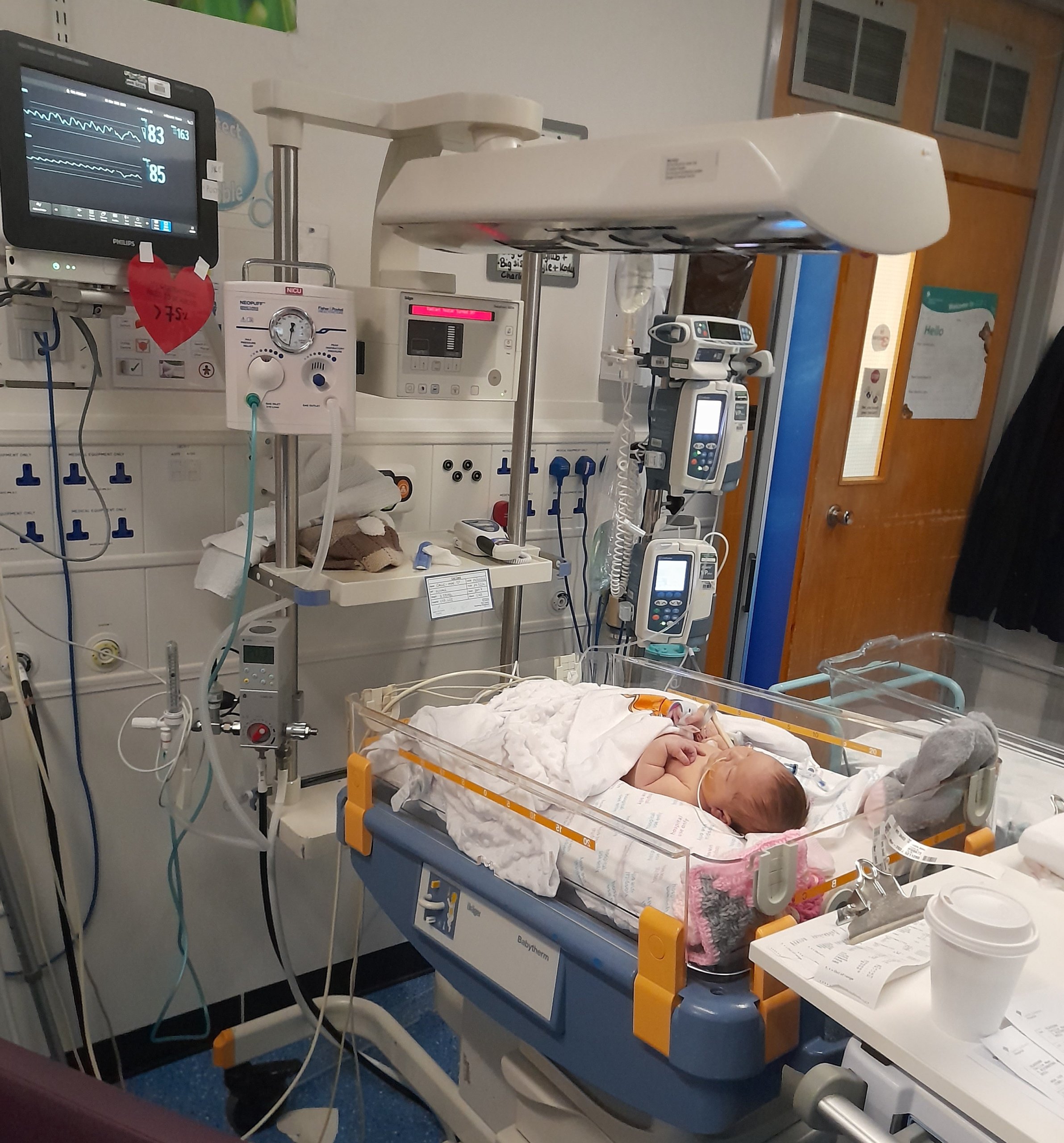 Small baby in hospital surrounding by lots of machines and tubes