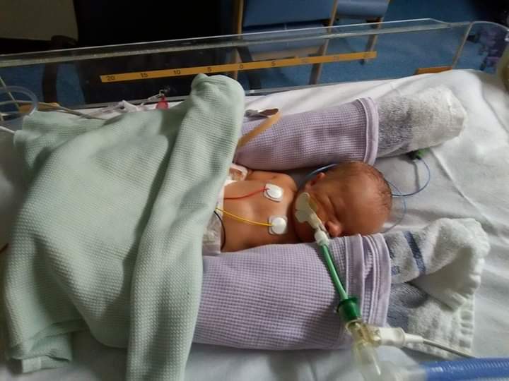 heart warrior james as a baby is hospital after heart surgery