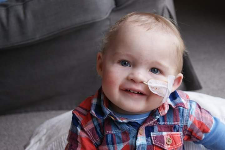 James as a toddler, feeding tube in nose. Smiling. Red and blue tartan shirt