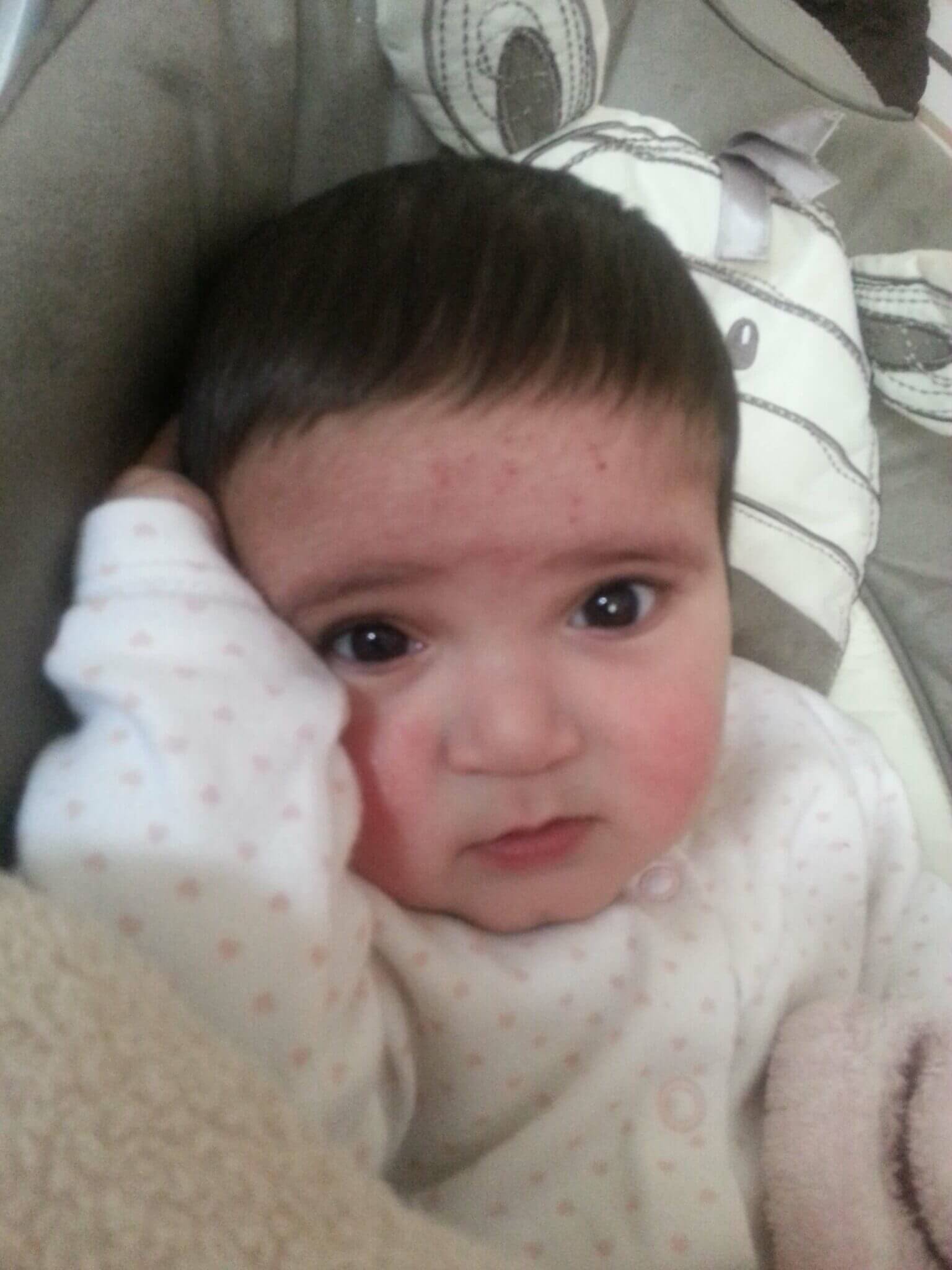 8 months old the day she got ill at home