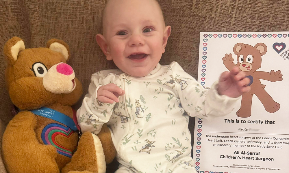 Albie’s story