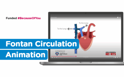 New CHD animation: Fontan Circulation