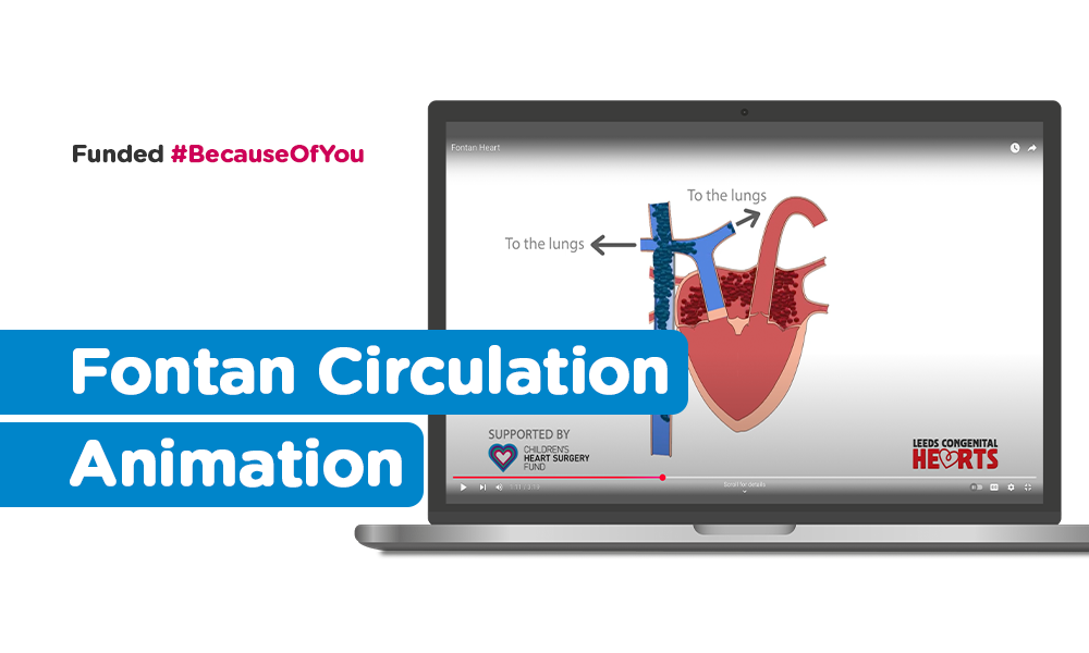 New CHD animation: Fontan Circulation