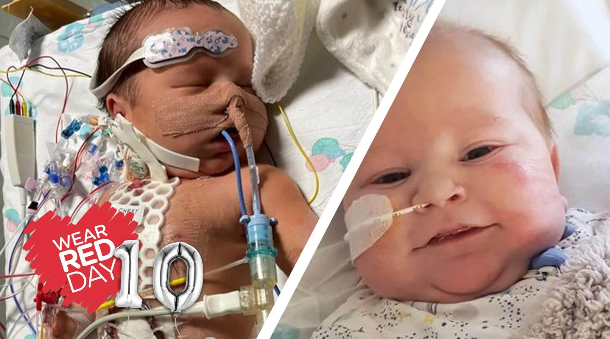 Mum of little heart hero Charlie urges city to support ‘Wear Red Day’