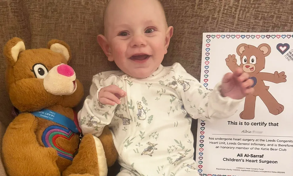 Albie’s story