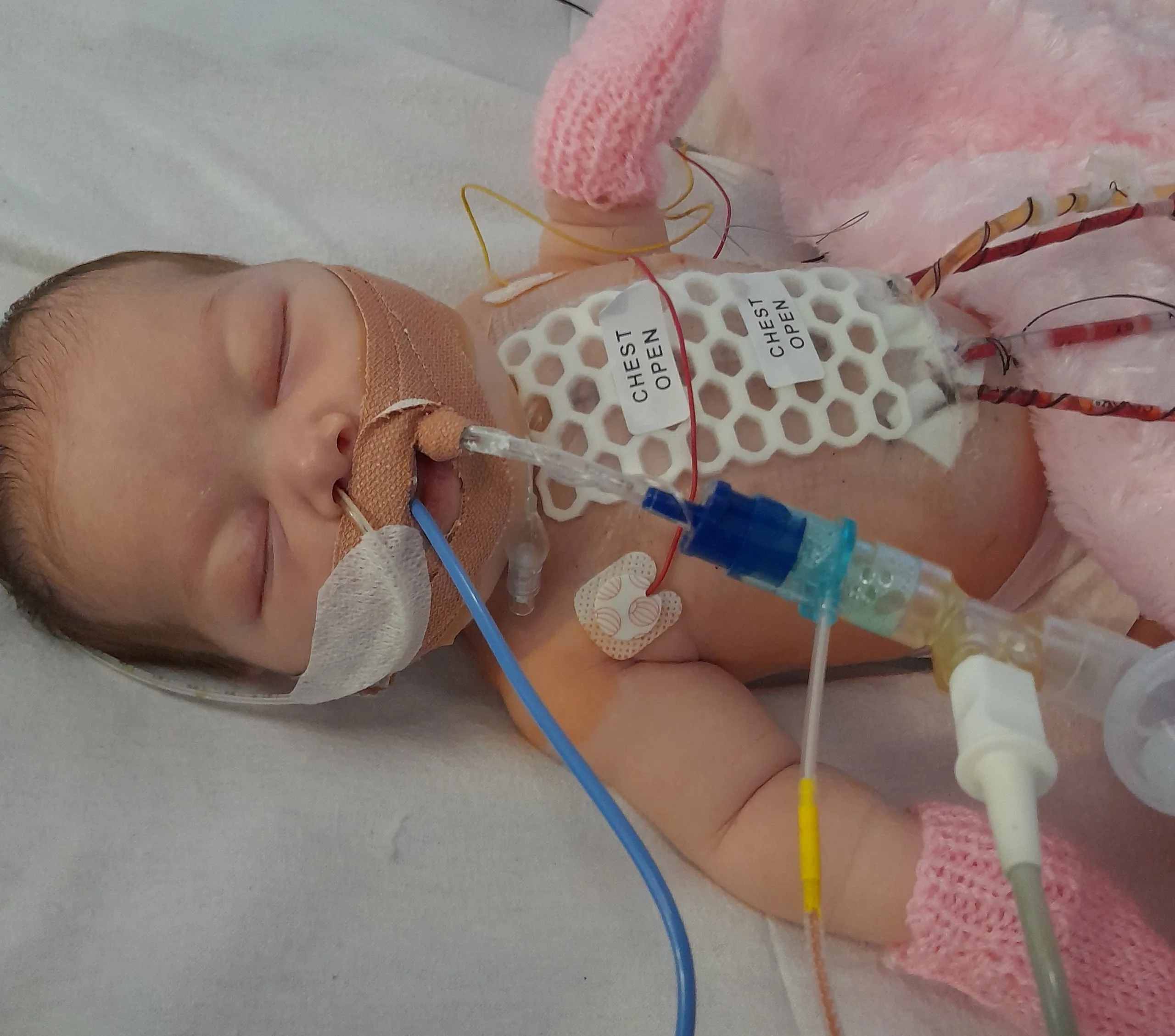 Small baby in hospital surrounding by lots of machines and tubes