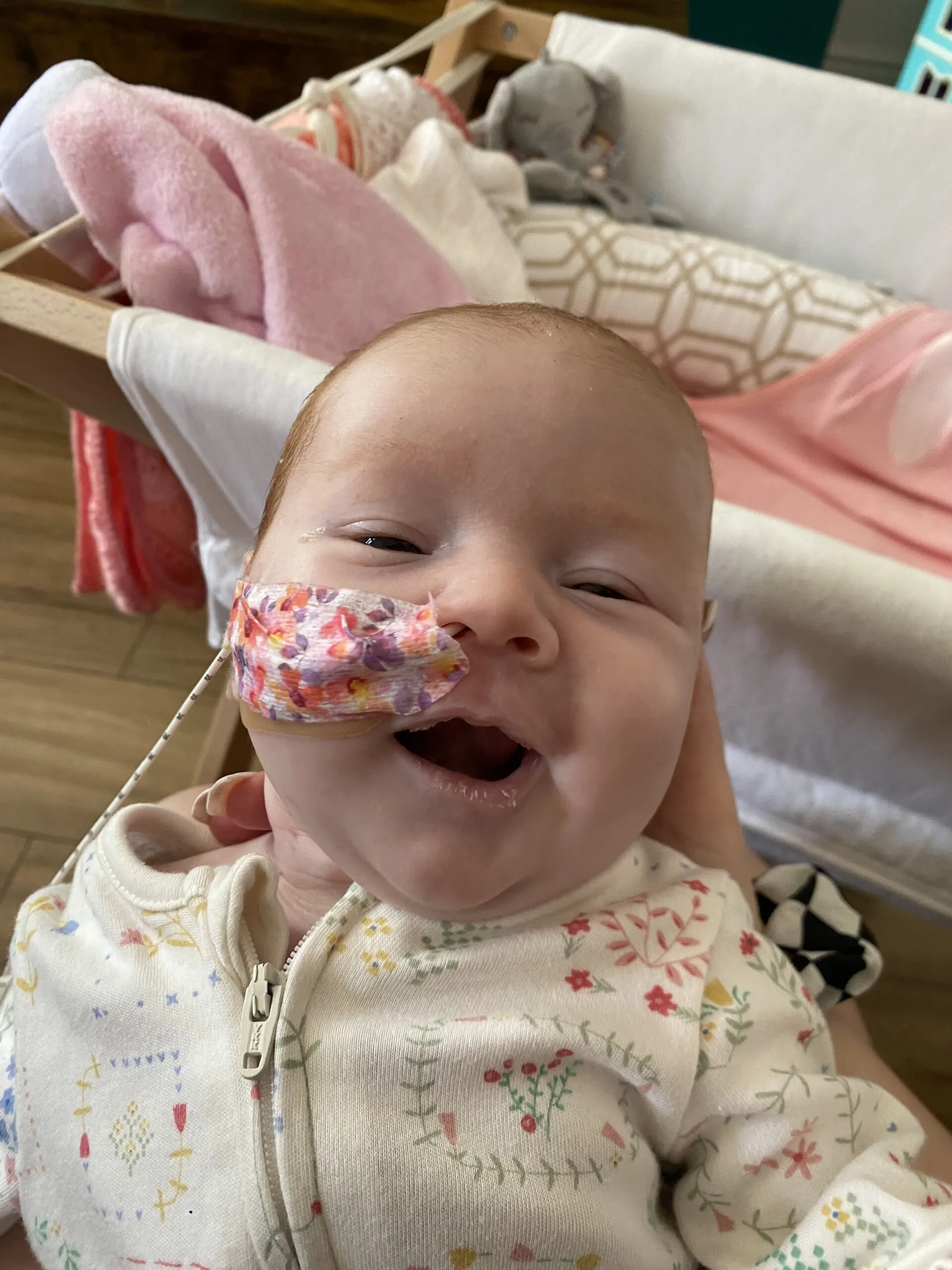 Baby Beau smiling with a feeding tube in her nose