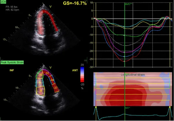New ECHO Software for LCHU